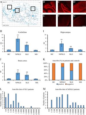 Brain-reactive autoantibodies in neuropsychiatric systemic lupus erythematosus